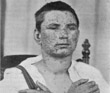 Smallpox vaccine