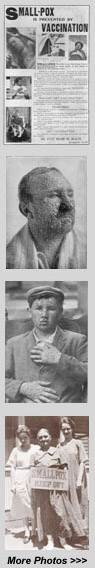 Smallpox Photos