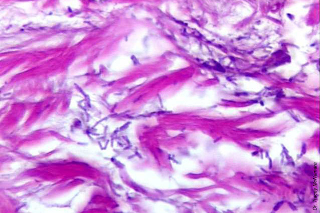 Bioterrorism Laboratory Testing