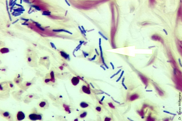 Bioterrorism Laboratory Testing