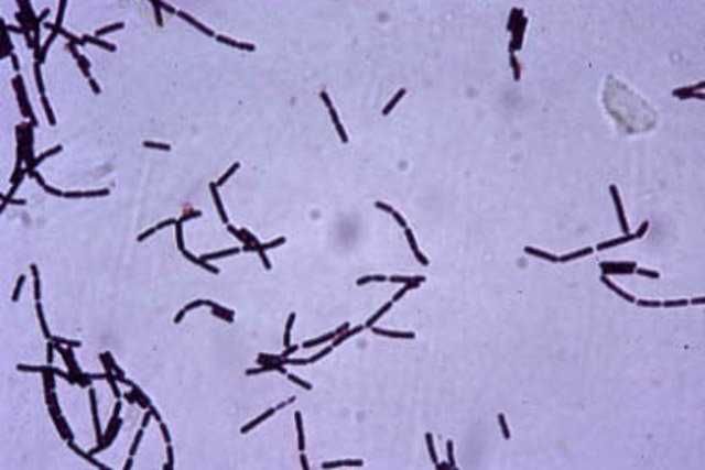 Bioterrorism Laboratory Testing
