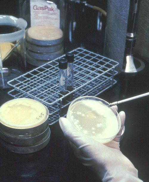 Bioterrorism Laboratory Testing