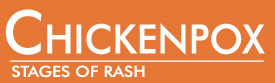 Chickenpox Stages of Rash