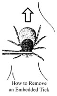 proper 
removal of a tick