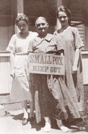 Smallpox Photo