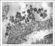Smallpox Vaccinations in Illinois